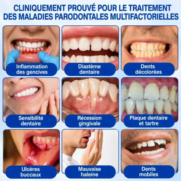 Glimmerly GumRevive – Gel de Réparation Parodontale