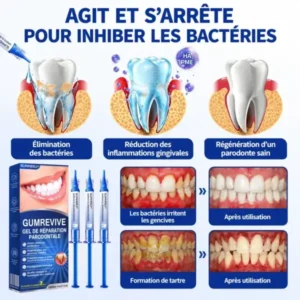 Glimmerly GumRevive – Gel de Réparation Parodontale
