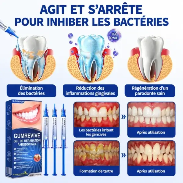 Glimmerly GumRevive – Gel de Réparation Parodontale