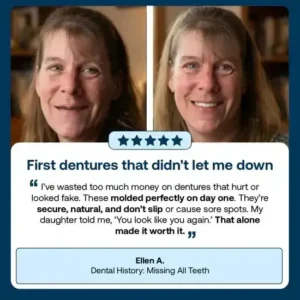HazyGalaxy™ Functional Dentures