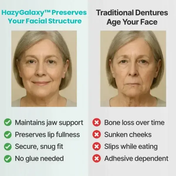 HazyGalaxy™ Functional Dentures