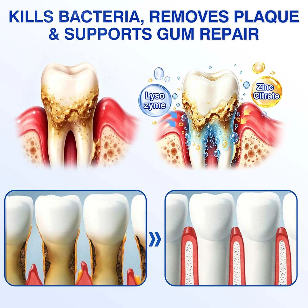 Healrize® GumRevive Periodontal Gel