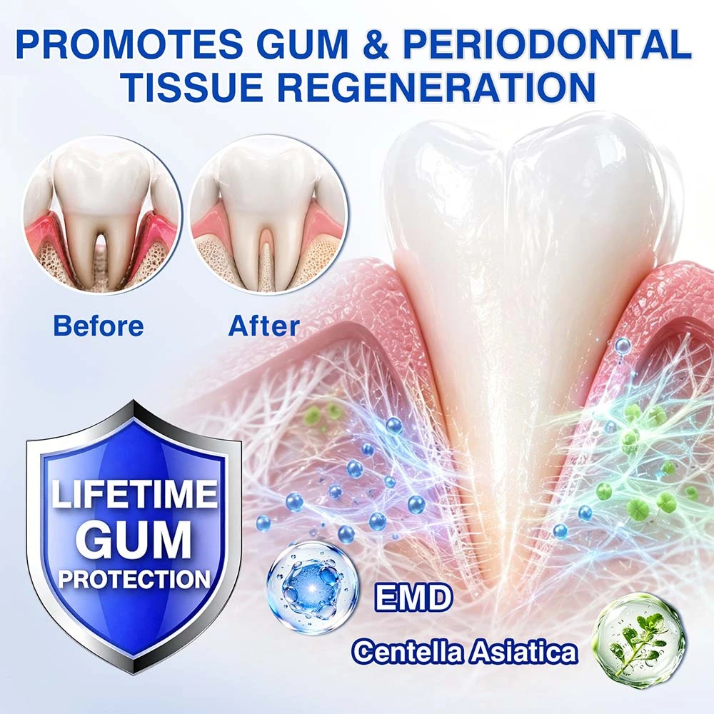 Healrize® GumRevive Periodontal Gel