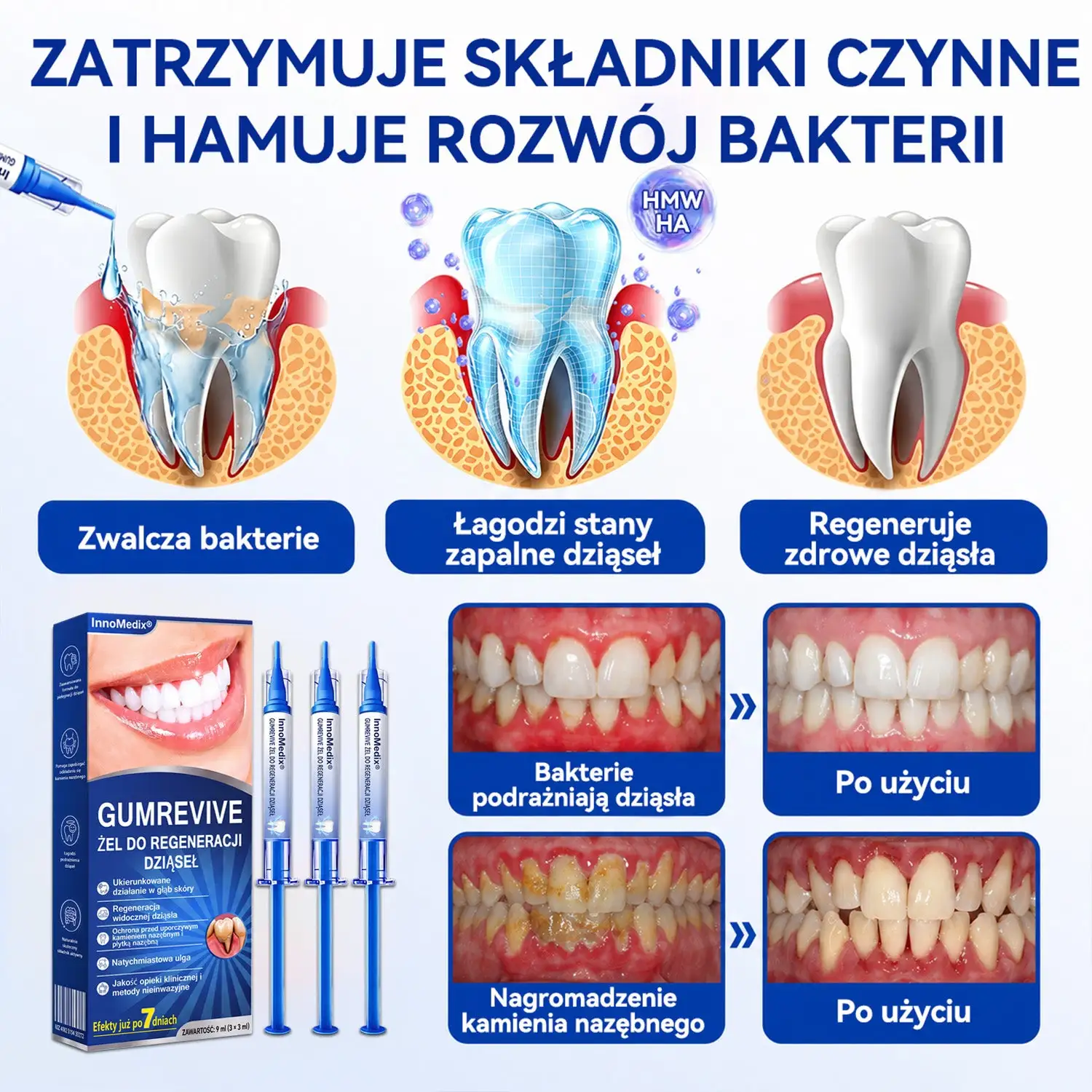 InnoMedix® GumRevive Żel Regenerujący Dziąsła - Dla zdrowszych dziąseł i pewniejszego uśmiechu