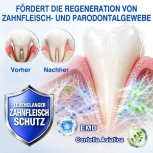 Luxarise® GumRevive Parodontal-Reparaturgel