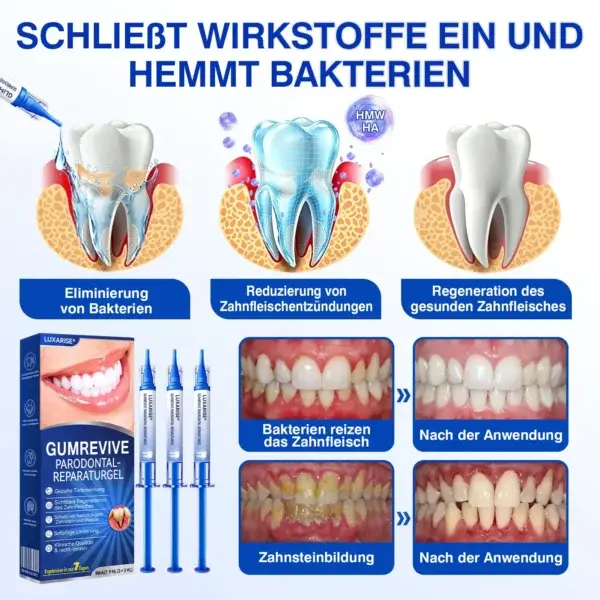 Luxarise® GumRevive Parodontal-Reparaturgel