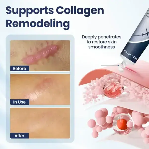 Texture Repair Gel