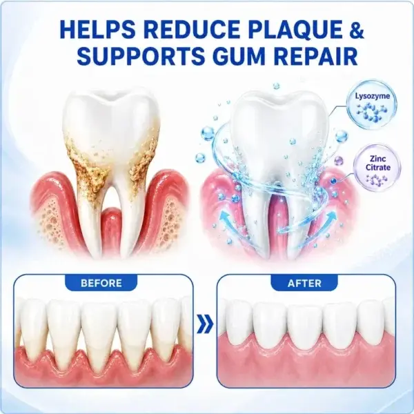 Pheromex® GumRevive Periodontal Care Gel