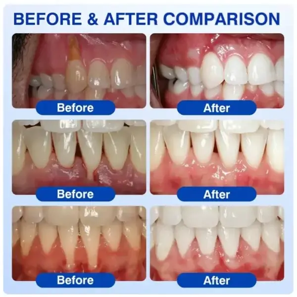 Pheromex® GumRevive Periodontal Care Gel