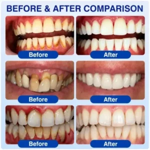 Pheromex® GumRevive Periodontal Care Gel