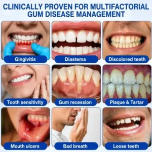 Pheromex® GumRevive Periodontal Care Gel