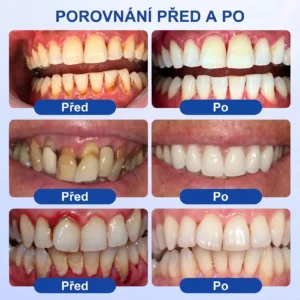PureShade® GumRevive – Regenerace dásní