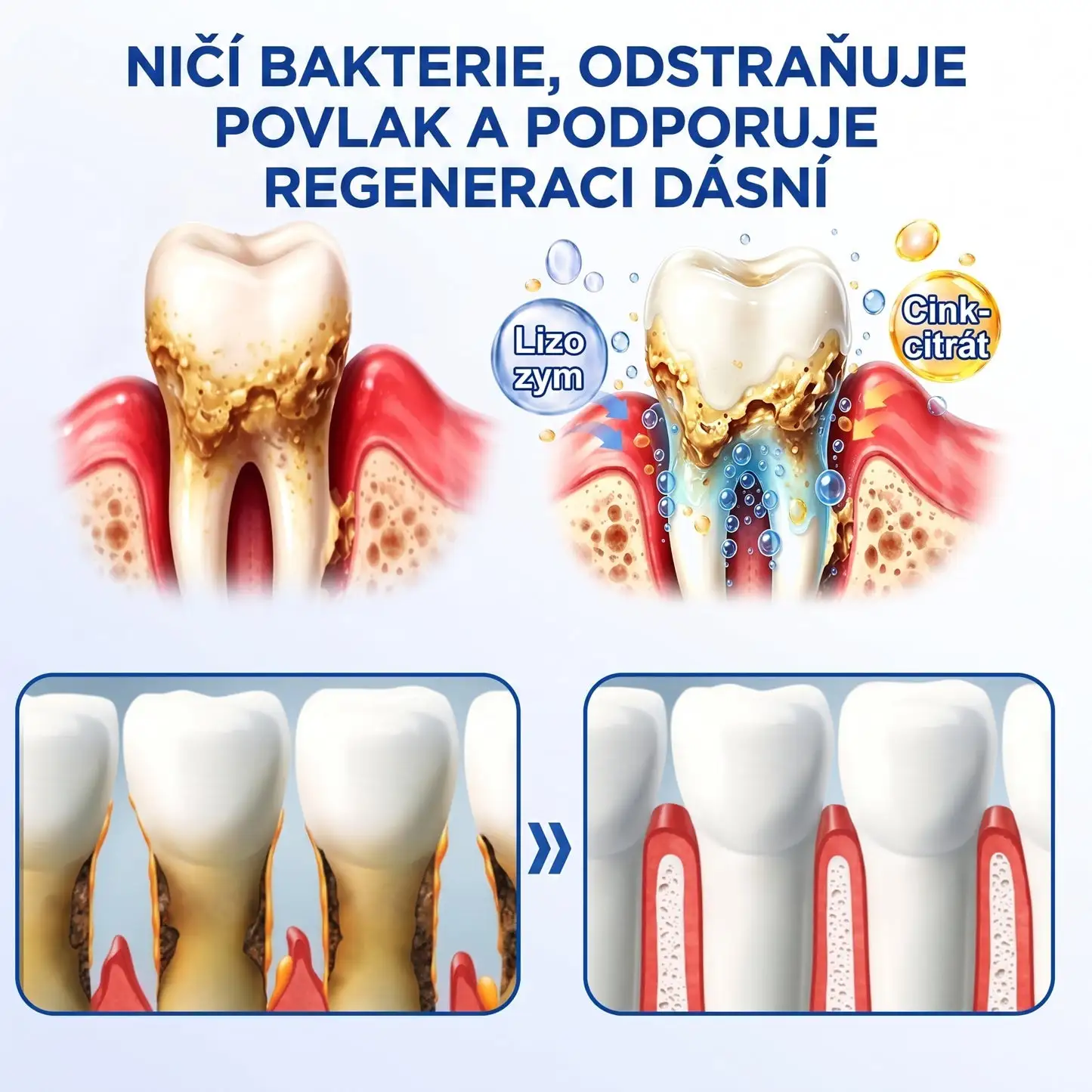PureShade® GumRevive – Regenerace dásní