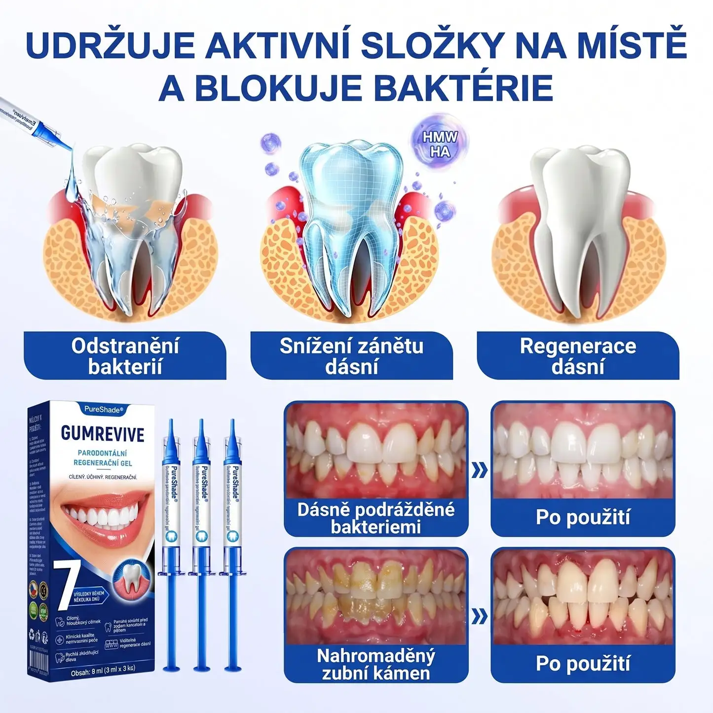 PureShade® GumRevive – Regenerace dásní