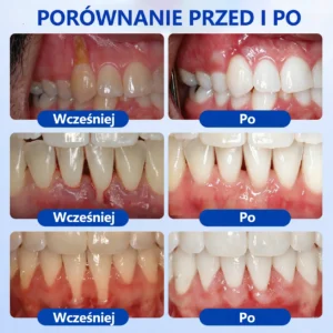 PureShade® GumRevive – Regeneracja dziąseł