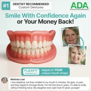 SEAGRIL™ Custom-Fit Full Functional Dentures