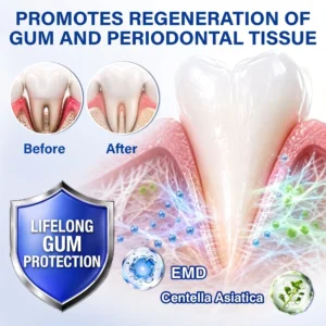 SOLAROZA® Gum Revive Periodontal Repair Gel