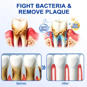 SOLAROZA® Gum Revive Periodontal Repair Gel