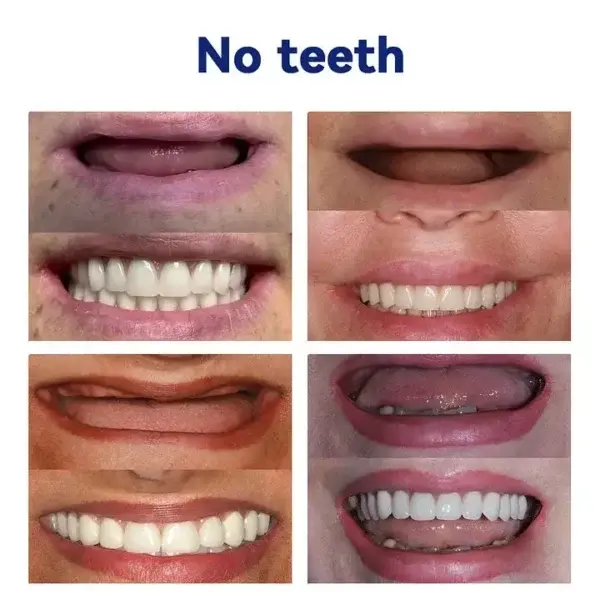 Vaxflite™ Ease Dentures