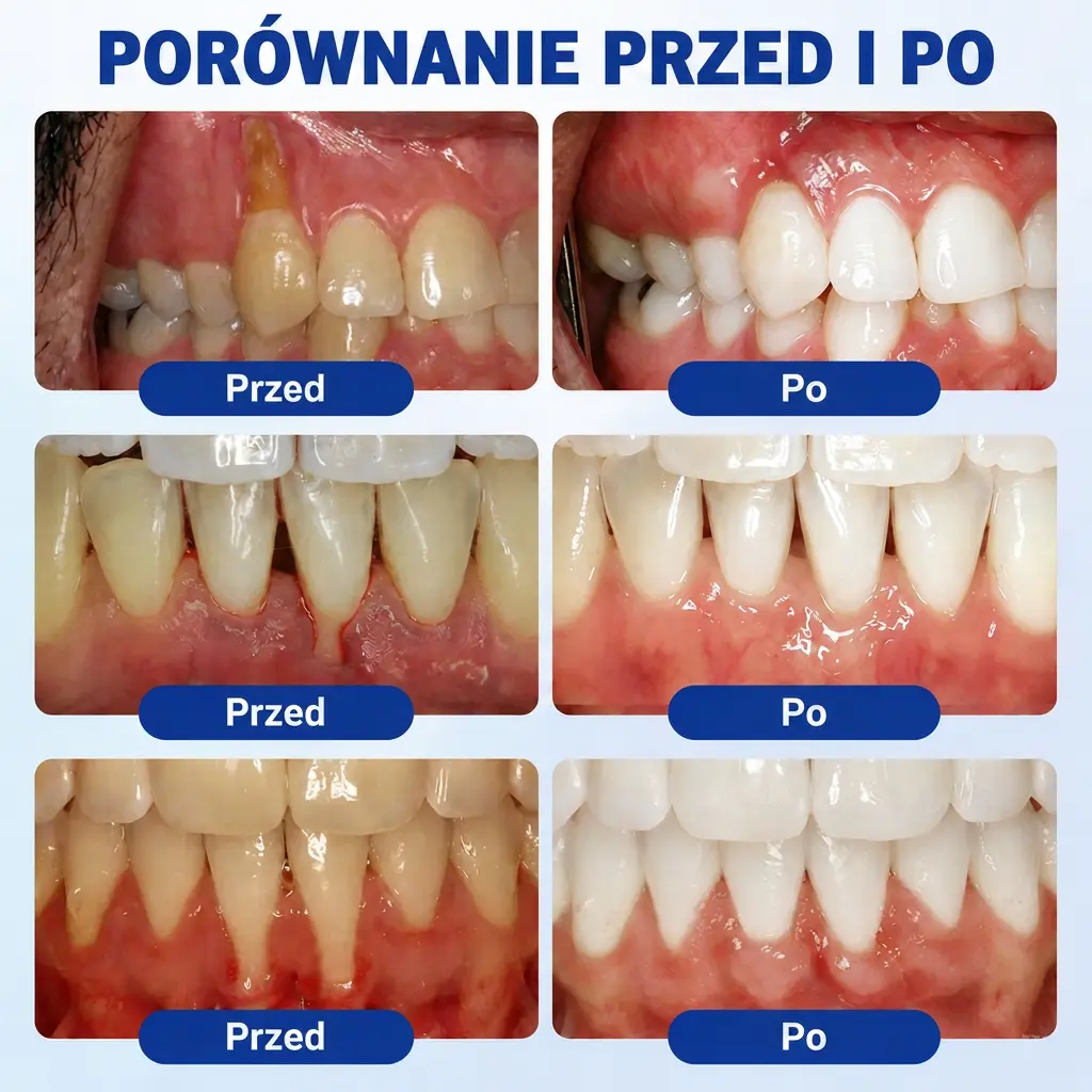 Vitalisys® GumRevive – regenerujący żel do dziąseł