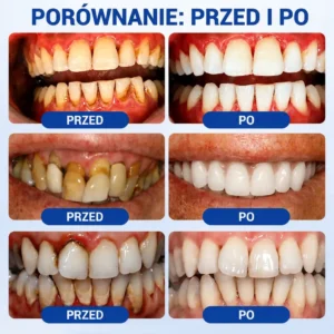 Vitalisys® GumRevive – regenerujący żel do dziąseł