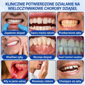 Vitalisys® GumRevive – regenerujący żel do dziąseł