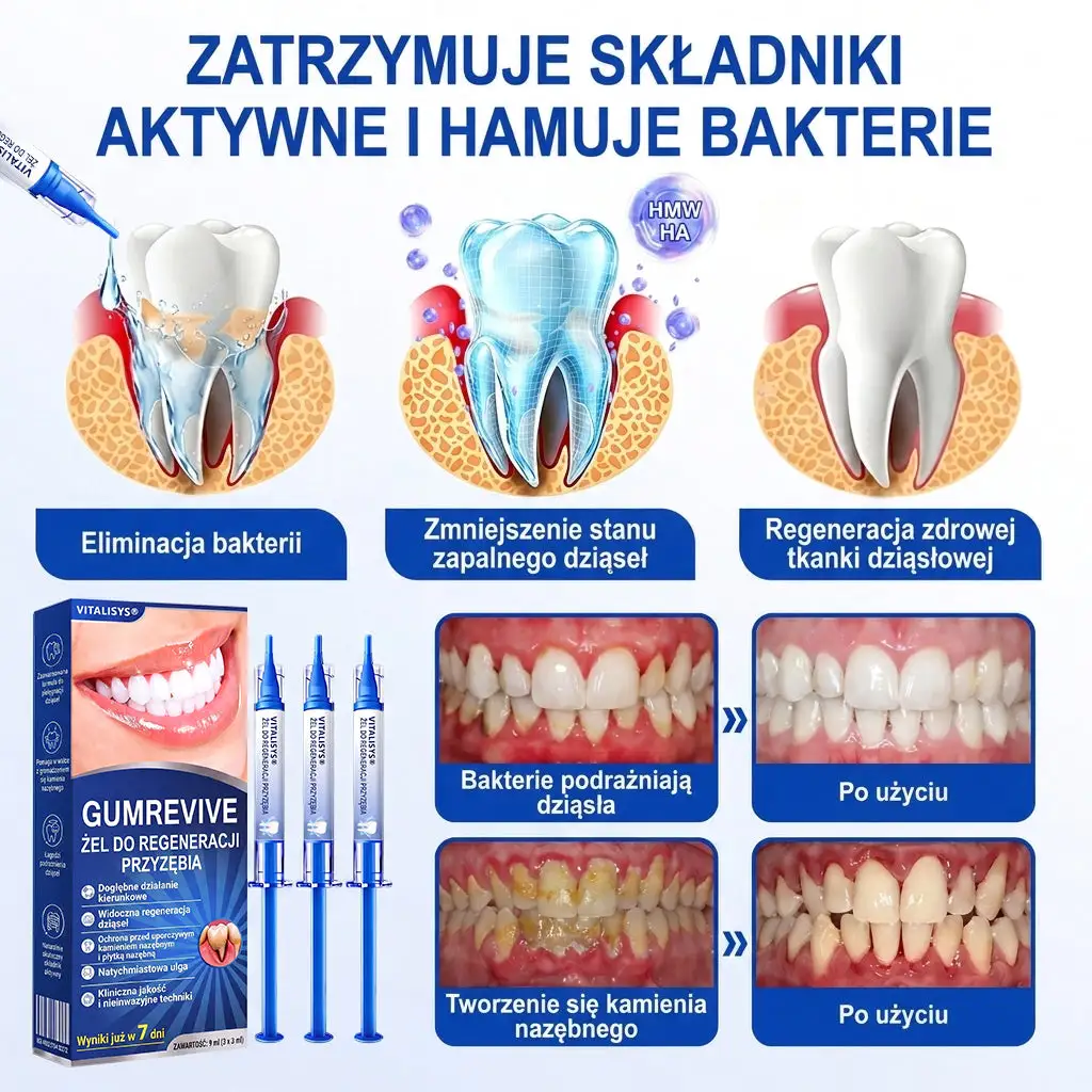 Vitalisys® GumRevive – regenerujący żel do dziąseł