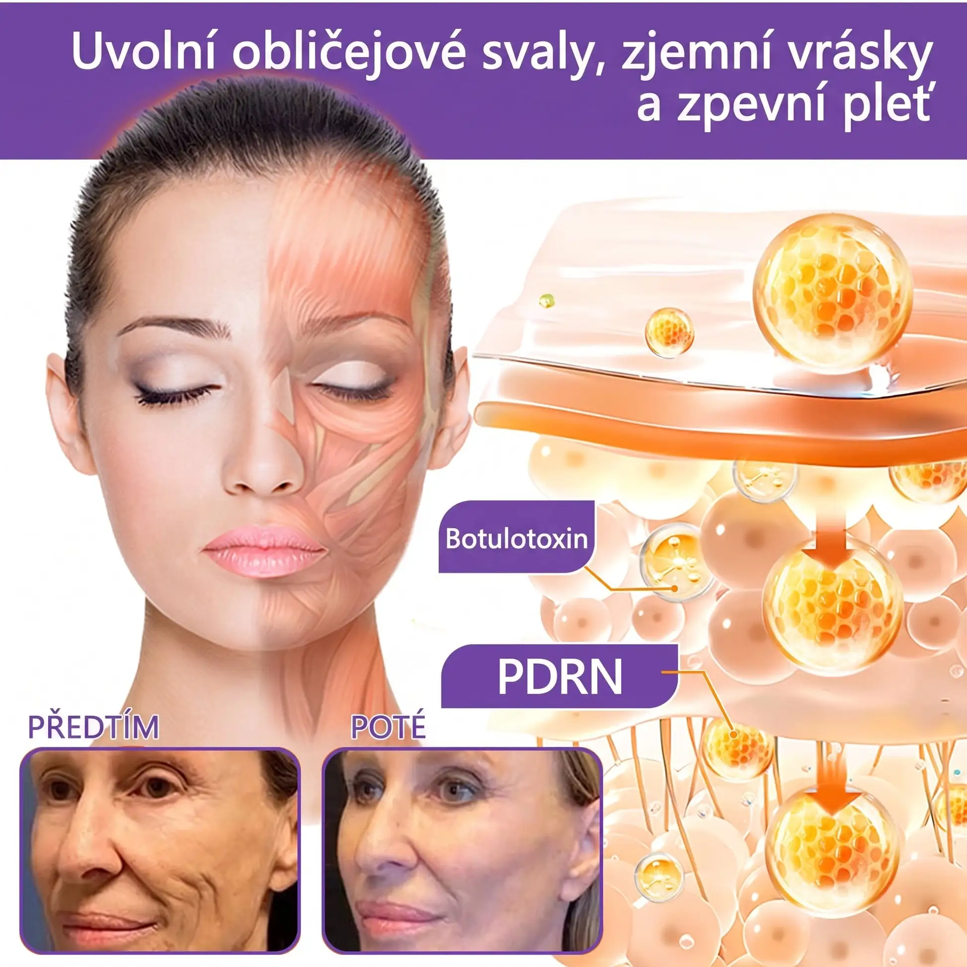 Vitalisys® PDRN Multi-Peptide masážní tělový krém s masážním válečkem