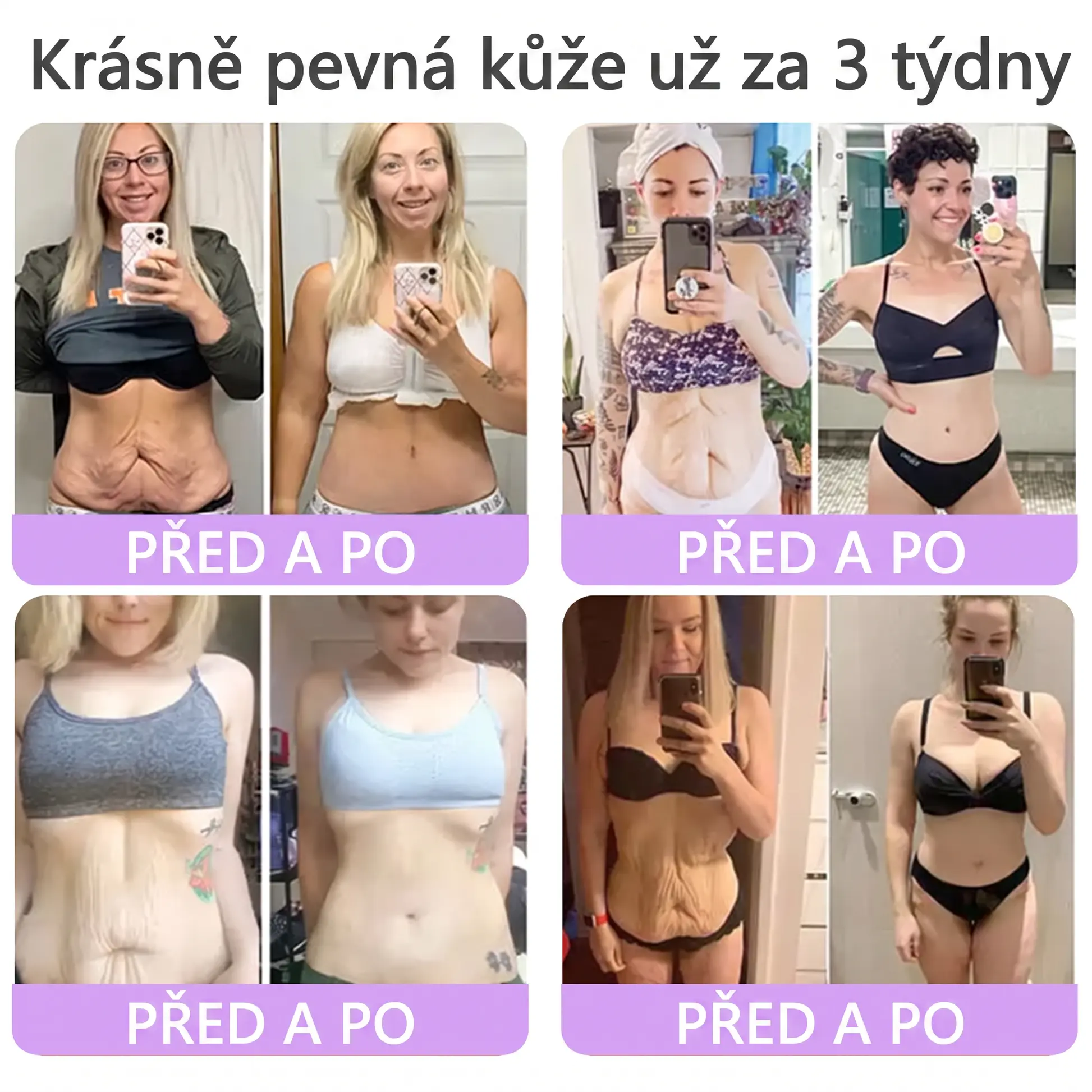 Vitalisys® PDRN Multi-Peptide masážní tělový krém s masážním válečkem