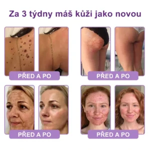Vitalisys® PDRN Multi-Peptide masážní tělový krém s masážním válečkem