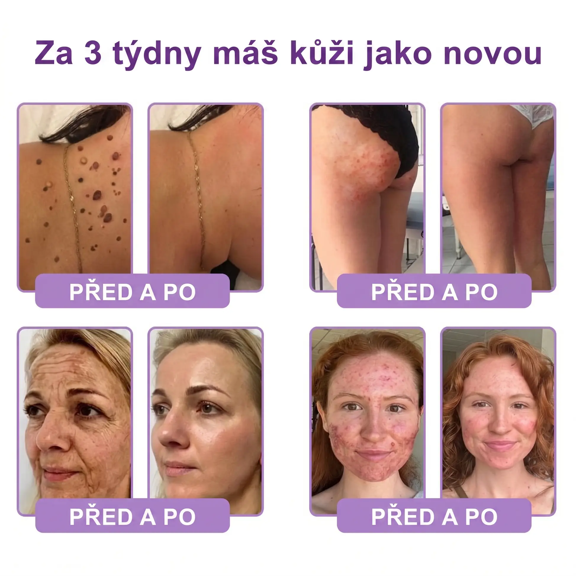 Vitalisys® PDRN Multi-Peptide masážní tělový krém s masážním válečkem