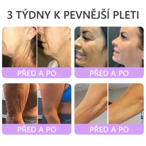 Vitalisys® PDRN Multi-Peptide masážní tělový krém s masážním válečkem