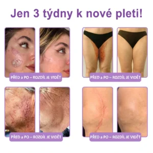 Vitalisys® PDRN Multi-Peptide masážní tělový krém s masážním válečkem