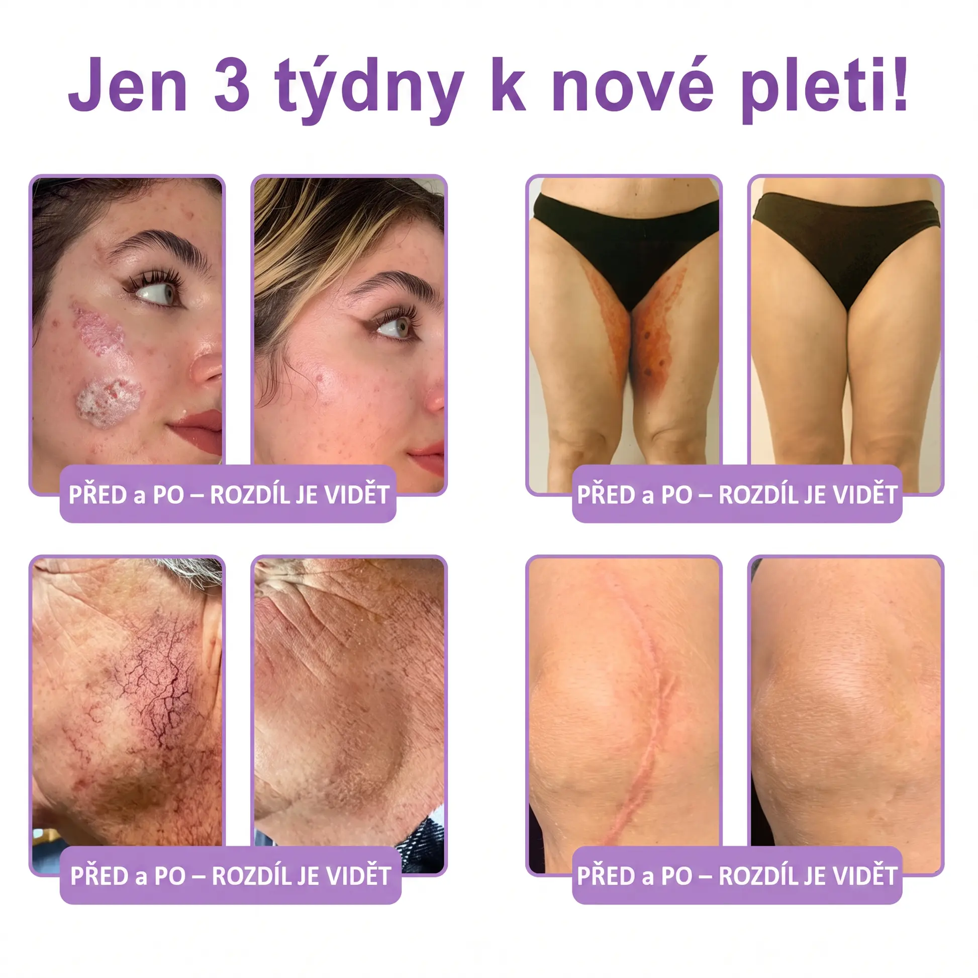 Vitalisys® PDRN Multi-Peptide masážní tělový krém s masážním válečkem