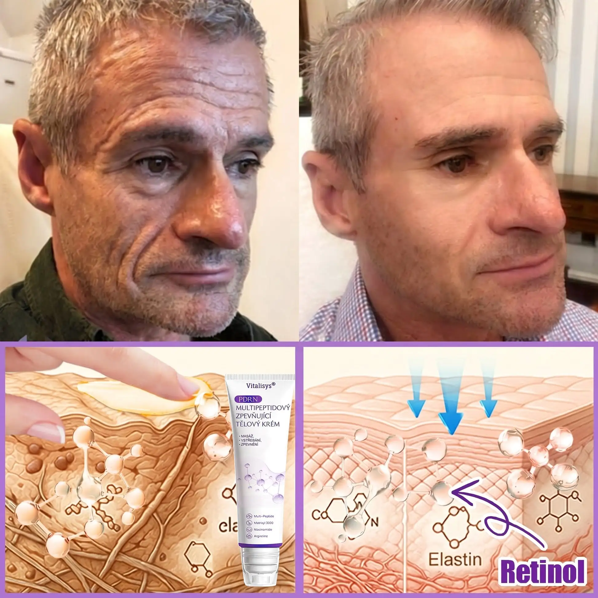 Vitalisys® PDRN Multi-Peptide masážní tělový krém s masážním válečkem