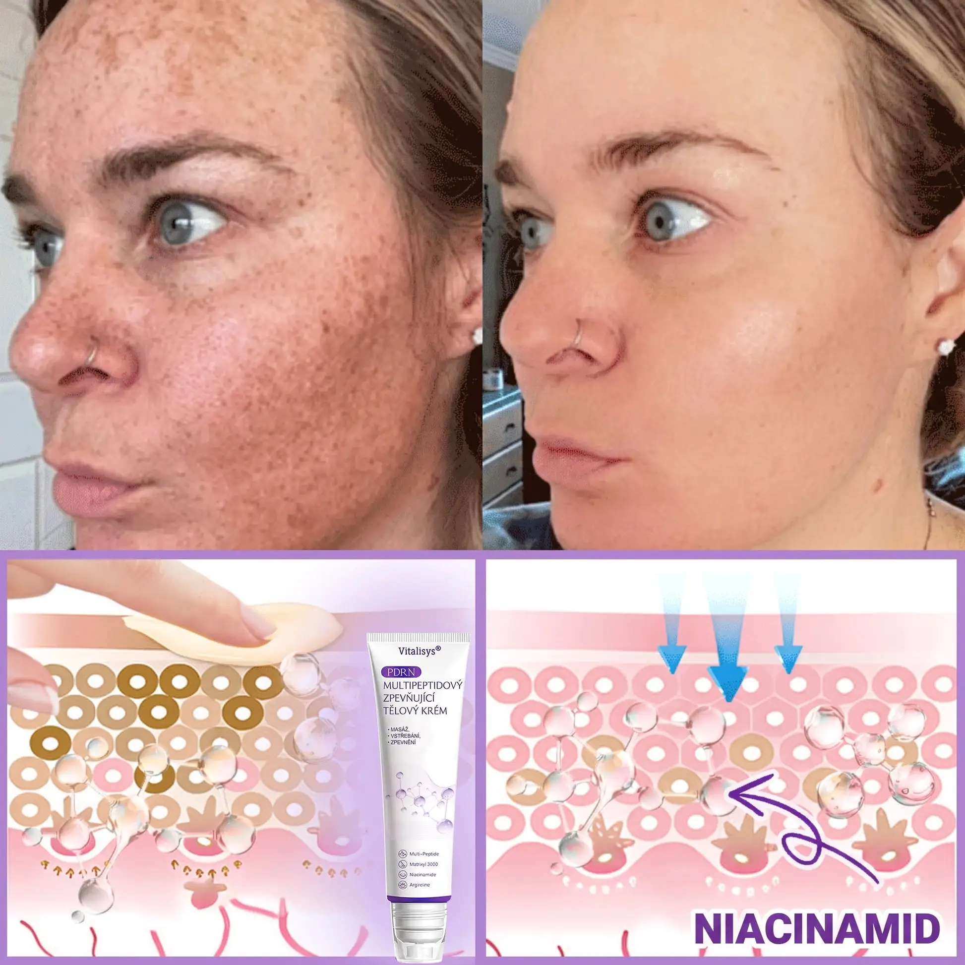 Vitalisys® PDRN Multi-Peptide masážní tělový krém s masážním válečkem